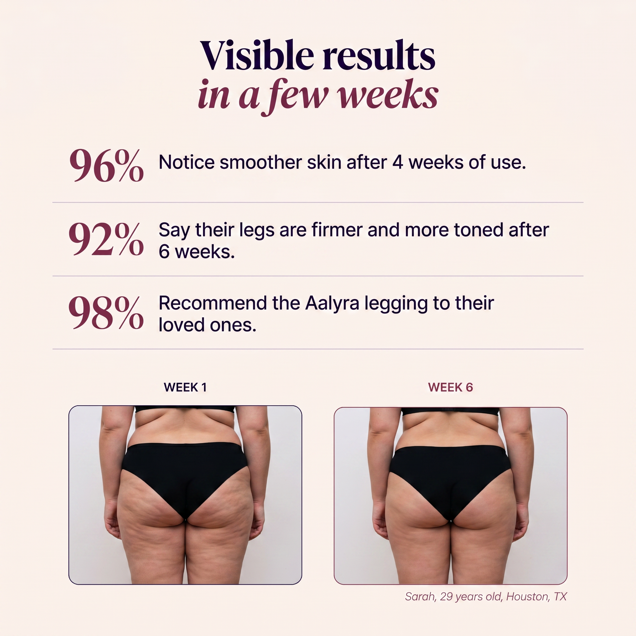 3D Anti-Cellulite Leggings – Lift & Smooth